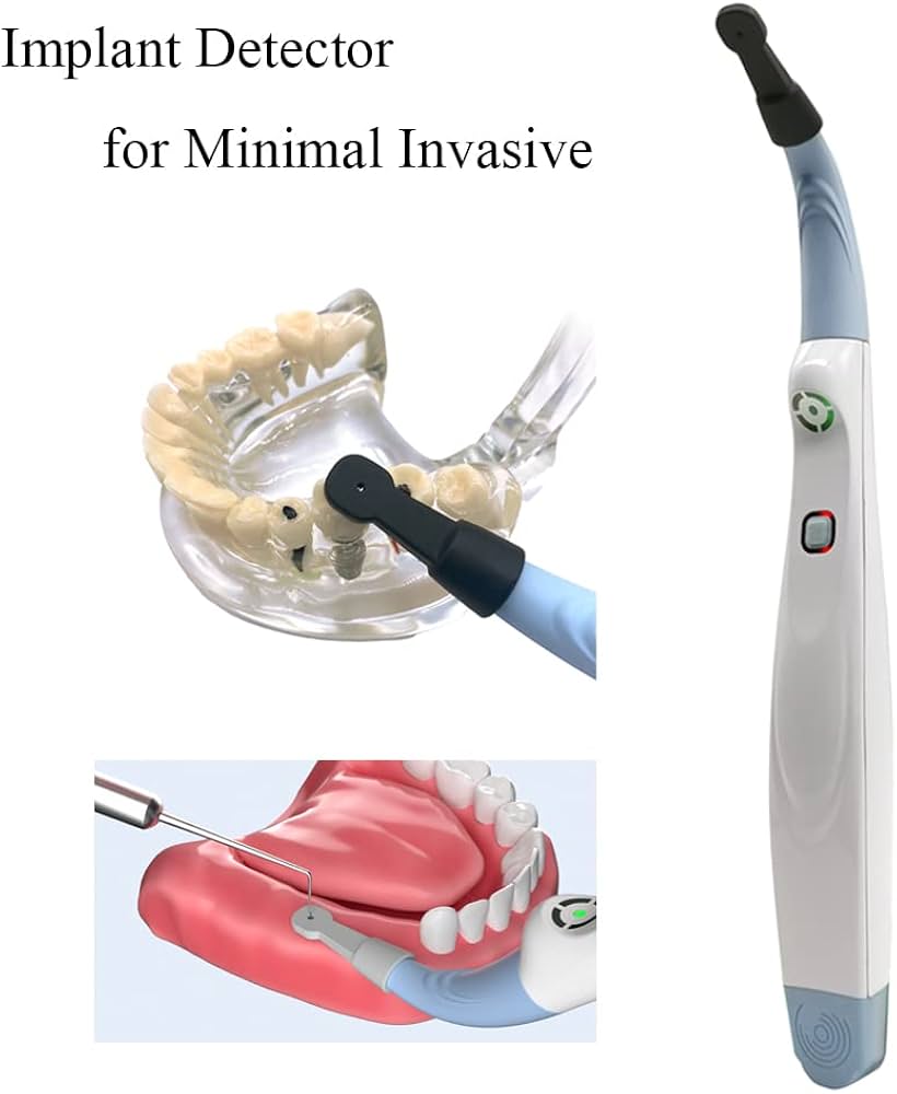 インプラントロケーター「光で知らせるインプラント探知機」 インプラントロケーター「光で知らせるインプラント探知機」